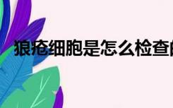 狼疮细胞是怎么检查的（什么是狼疮细胞）