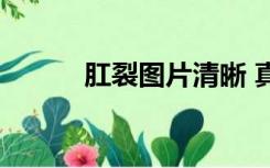 肛裂图片清晰 真实（肛裂图片）