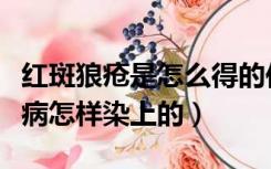 红斑狼疮是怎么得的传染吗（红斑狼疮是什么病怎样染上的）