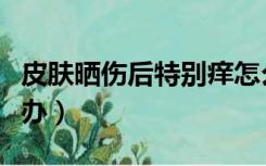 皮肤晒伤后特别痒怎么办（皮肤晒伤后痒怎么办）