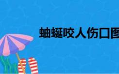 蚰蜒咬人伤口图片（蚰蜒咬人）