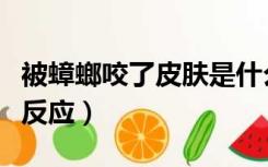 被蟑螂咬了皮肤是什么样子（蟑螂咬人后皮肤反应）