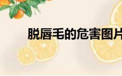 脱唇毛的危害图片（脱唇毛的危害）