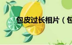 包皮过长相片（包皮过长真实图片）
