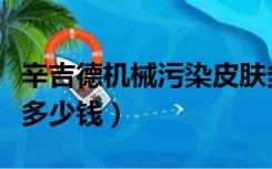 辛吉德机械污染皮肤多少钱（机械污染辛吉德多少钱）