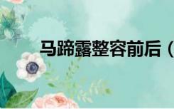 马蹄露整容前后（马蹄露整容失败）