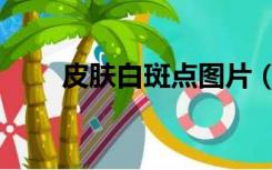 皮肤白斑点图片（皮肤白斑有几种）