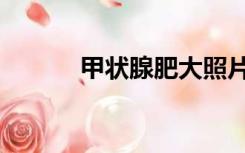 甲状腺肥大照片（甲状腺肥大）