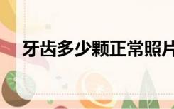 牙齿多少颗正常照片（牙齿多少颗正常）