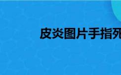 皮炎图片手指死皮（皮炎图片）