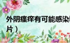 外阴瘙痒有可能感染hpv哪一项（外阴瘙痒图片）