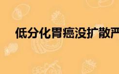 低分化胃癌没扩散严重吗（低分化胃癌）