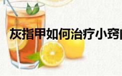 灰指甲如何治疗小窍门（灰指甲如何治疗）