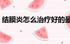 结膜炎怎么治疗好的最快（结膜炎怎么治疗）