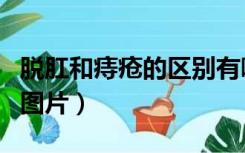 脱肛和痔疮的区别有哪些（脱肛和痔疮的区别图片）