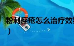 粉刺痤疮怎么治疗效果好（粉刺痤疮怎么治疗）