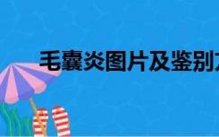 毛囊炎图片及鉴别方法（毛囊炎图片）