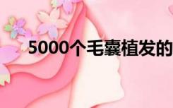 5000个毛囊植发的价格（植发的价格）