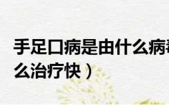 手足口病是由什么病毒引起的（手足口病是怎么治疗快）