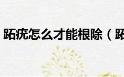 跖疣怎么才能根除（跖疣用什么药膏能治好）