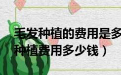 毛发种植的费用是多少（毛发种植介绍 毛发种植费用多少钱）