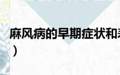 麻风病的早期症状和表现（麻风病的早期症状）
