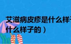 艾滋病皮疹是什么样子的症状（艾滋病皮疹是什么样子的）