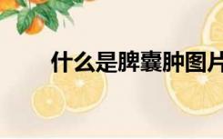 什么是脾囊肿图片（什么是脾囊肿）