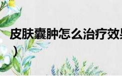 皮肤囊肿怎么治疗效果好（皮肤囊肿怎么治疗）
