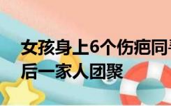 女孩身上6个伤疤同寻人启事一致 失散17年后一家人团聚